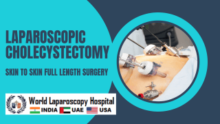 Laparoscopic Cholecystectomy Fully Explained Skin-to-Skin Video with Near Infrared Cholangiography