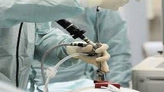 Laparoscopic Dissection Techniques part 1