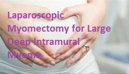 Laparoscopic Myomectomy for Large Deep Intramural Myoma