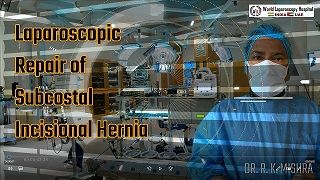 Laparoscopic Repair of Subcostal Incisional Hernia