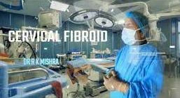 Laparoscopic Removal of Posterior Cervical Fibroid