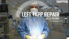 TAPP Hernia Repair by Ipsilateral Port