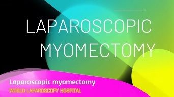 Laparoscopic Myomectomy for Intramural Fibroid