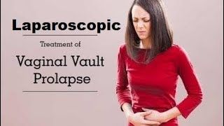 Laparoscopic Sacrocolpopexy for Vault Prolapse