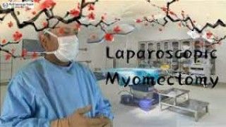 Laparoscopic Myomectomy for Posterior Wall Fibroid Uterus with Endometriosis (4 K Video)