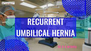 Laparoscopic Repair of Recurrent Umbilical Hernia