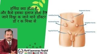 Safe Use of Electrosurgery in Laparoscopy Part I - Lecture by Dr R K Mishra