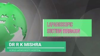 Laparoscopic Cholecystectomy by Dr. R.K. Mishra