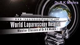 Laparoscopic Myomectomy with intra corporeal Double Layer Suturing