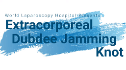 Mastering Laparoscopic Technique: Recurrent Incisional Hernia Repair by Laparoscopy Simplified