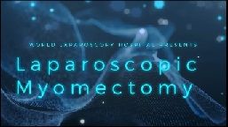 Live Video of Diagnostic Laparoscopy, Hysteroscopy and Dye Test for Infertility