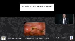 Laparoscopic Management of Ectopic Pregnancies Lecture - Dr. R. K. Mishra