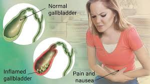 Laparoscopic Dissection Techniques Part 2