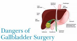 Total Laparoscopic Hysterectomy High Definition Video