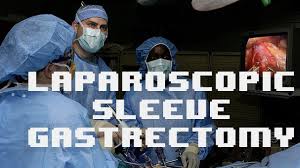 IPOM Umbilical Hernia Repair by VIPRO II Mesh