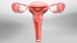 Ovarian cystectomy for Left Ovarian Cyst