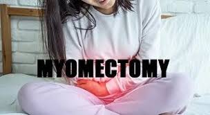 Supracervical Hysterectomy and Sacrocolpopexy