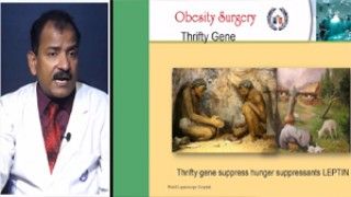 Laparoscopic Repair of Incisional Hernia: A Detailed Surgical Procedure by Dr. R.K. Mishra