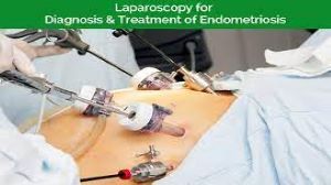 Laparoscopic Myomectomy by Mishra's Knot