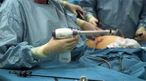 Successfully addressing both sides of recurrent inguinal hernias through laparoscopic repair