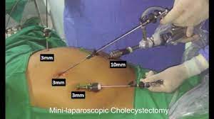 Dubai Laparoscopy Training: Surgeon's Journey to Excellence