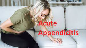 Laparoscopic Appendectomy for Acute Appendicitis