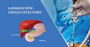 First Remote Robotic Telesurgery on Human Conducted at World Laparoscopy Hospital