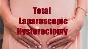 Total Laparoscopic Hysterectomy with Sacrocolpopexy