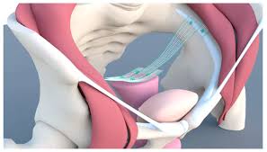 Bilateral Inguinal Hernia Surgery Trans Abdominal Preperitoneal Repair