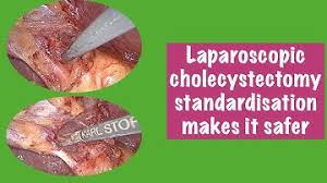 Unedited Full Length Laparoscopic Cholecystectomy HD Video - Dr R K Mishra