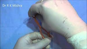 Pediatric Laparoscopic Cholecystectomy and Appendectomy in Same Patient by Two Ports