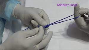 Laparoscopic Mishra's Knot