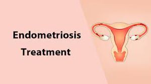 Laparoscopic Weston Knot