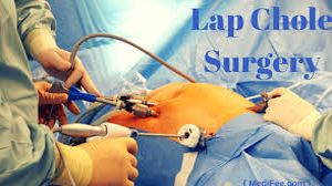 Laparoscopic Hysterectomy And Appendectomy Using Illuminated Ureteral Stent Step Step Demonstration