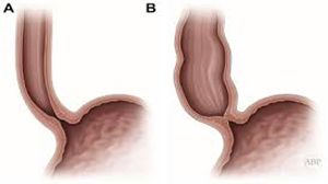 Gynecological Surgery at World Laparoscopy Hospital