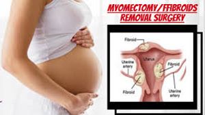 Laparoscopic Myomectomy HD Video for Multiple Myoma using Mishra's Knot