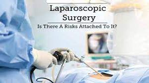 Exploring the Laparoscopic Veress Needle: A Key Instrument for Minimally Invasive Surgery