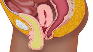 Mastering Single Instrument Dissection in Laparoscopic Incisional Hernia Repair