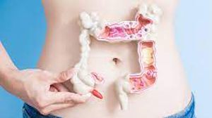 Diagnosis of intestinal endometriosis by laparoscopic surgery