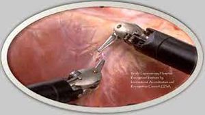 Video of da Vinci Robotic Adhesiolysis and tubal ligation for chronic abdominal pain