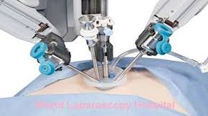 Revolutionizing Umbilical Hernia Surgery: Single 10mm Port Technique