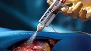 TAPP Laparoscopic Hernia Repair using Fibrin Glue by Dr R K Mishra
