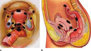 Endoscopy Training at World Laparoscopy Hospital