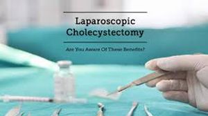 Laparoscopic Cholecystectomy by Dr. R.K. Mishra