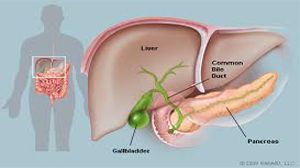 Laparoscopic Bilateral Inguinal Hernia Repair