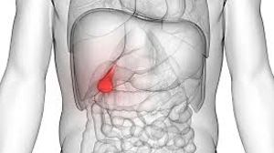 Robotic Bilateral Ovarian Cystectomy