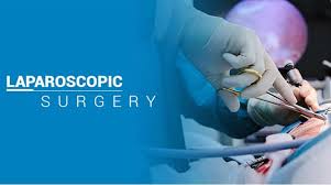 Diagnostic Laparoscopy and Tubal Patency Test