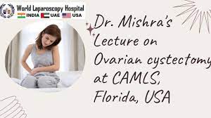 Ovarian cystectomy for Right Ovarian Cyst