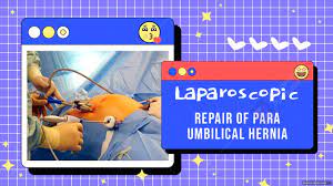 Laparoscopic Vesicovaginal Fistula Repair Lecture by Dr R K Mishra