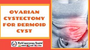 Dermoid Ovarian Cystectomy by Laparoscopy